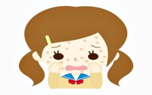 防疫狂冒生理痘 中醫還粉領族美肌