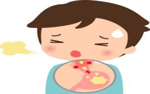 胃酸逆流 中醫針藥可改善